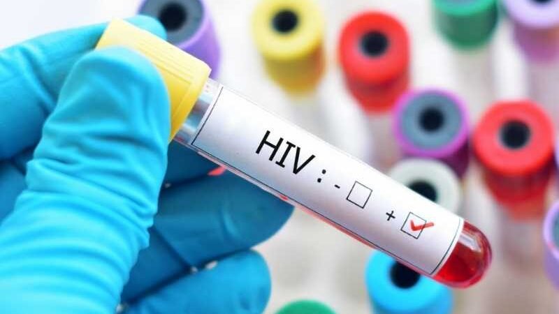 Novo antiviral garante proteção total contra HIV em jovens africanas